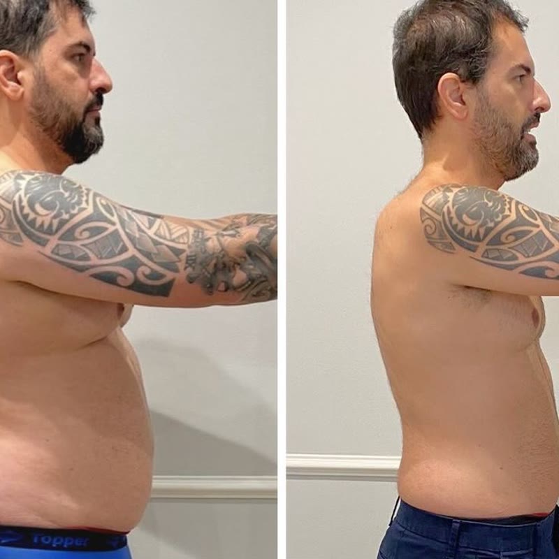 Paciente antes y después del tratamiento